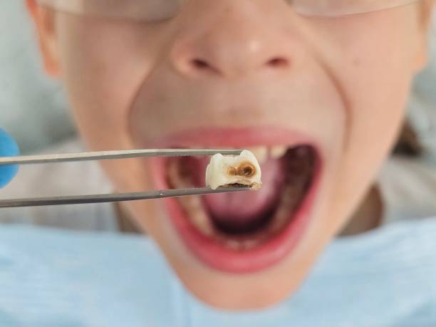 Best Holiday Emergency Dentist in Enetai, WA